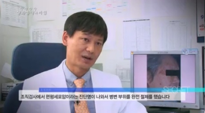 [생로병사의 비밀]여름 햇빛을 차단하라